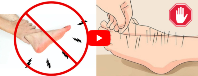 Nerve Repair Protocol